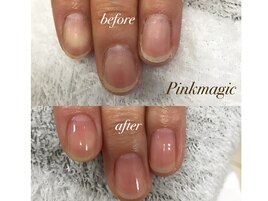 ネイルケア前後