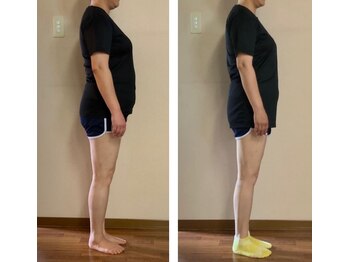 アルマ(ALMA)/50代女性：６ヶ月6.4kg!