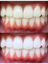 ホワイトニングセンター 大阪羽曳野店