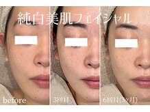 ハティア(hattia)/疲れ顔知らず！シミくすみ解消◎