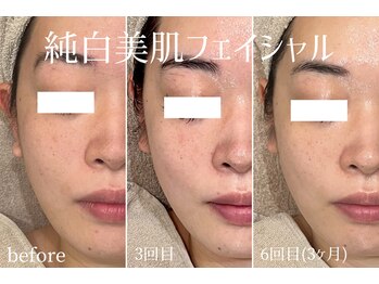 ハティア(hattia)/疲れ顔知らず！シミくすみ解消◎