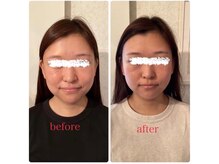 ドクター ヴィーナス/小顔矯正