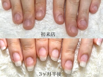 グラシナ なんば店/深爪/自爪育成/フィルイン