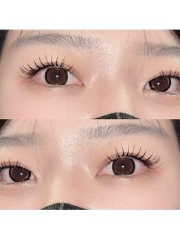 アース 津田沼店(EARTH Eye & Aesthetic)/アンドヘルシー(160本)