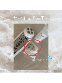 アンジュ/Before&After