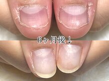 グラシナ 鳥丸店/(深爪/長さだし/フィルイン/)