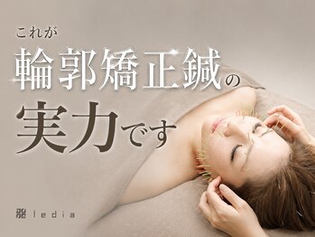 ルディア 堂島店(ledia)/大阪美容鍼|輪郭矯正鍼の実力