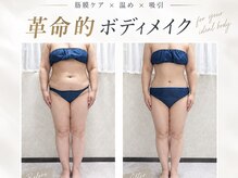 サロン ド スー(Salon de Suu)の雰囲気（結果出し◎この夏は理想の美ボディーに！）