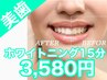 4月限定!!電動歯ブラシプレゼント!セルフホワイトニング15分3980円→3580円