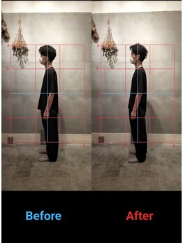 キナリ 新宿(CINARI)/CINARI　新宿　トレス整体　術後