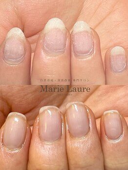 マリーロール 梅田店(Marie Laure)/自爪育成/深爪矯正/ネイルケア