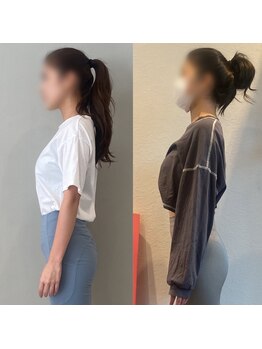 ホリック アイス コア ボディ(HOLIC ICE CORE BODY)/お客様ビフォーアフター1