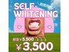 【一度で2トーン白くなる♪】セルフでホワイトニング都度5500円→3500円