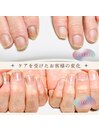 美爪育成ケア