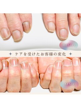 シーグラス(SeaGlass)/美爪育成ケア