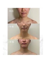 お顔の研究所/ビフォーアフター写真♪