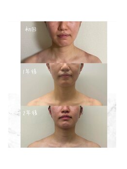 お顔の研究所/ビフォーアフター写真♪