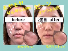 プレジール(plaisir)