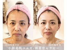 小顔美肌コルギ専門店 センティード 吉祥寺(Sentido)/