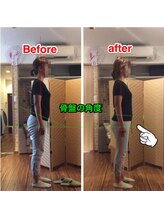 トレイン/反り腰の改善例