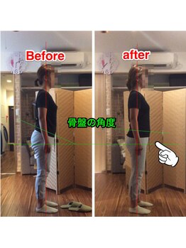 トレイン/反り腰の改善例