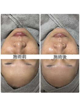 サラン スキンサロン(Sarang skin salon)/
