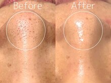 マイナプラ 表参道(myna+)/