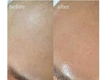 エクレ(eclat)/メイクのり格段にアップ！