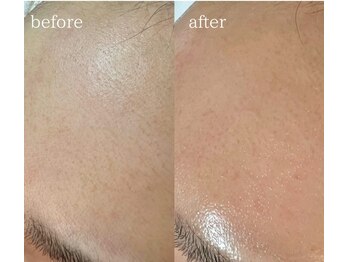 エクレ(eclat)/メイクのり格段にアップ！