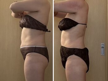 マイティー整骨院 ココア(CoCoa)/セルクラ