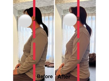 全力ストレッチ 川口店/Before/After 3 担当KAREN