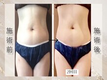 ミライ 福岡春日店(mirai)/即実感。