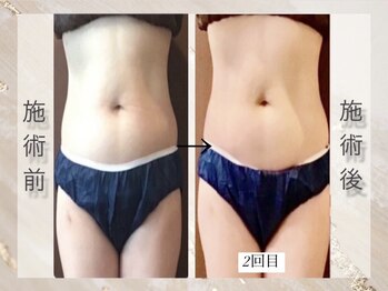 ミライ 福岡春日店(mirai)/即実感。