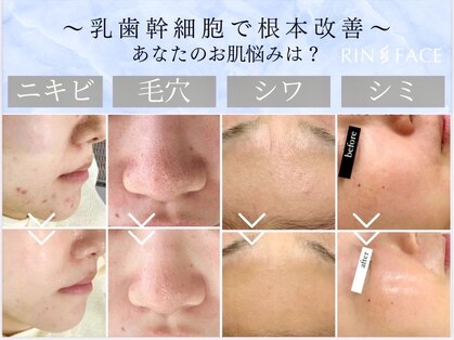 リンフェイス 浦安店(RINFACE)の写真