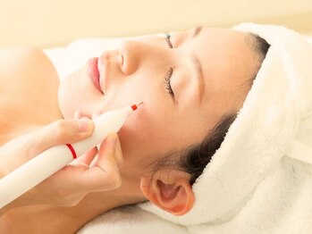 エメ(Aimer)の写真/【気になるシミに集中ケア！】厳選した機器を導入☆結果出しにこだわった技術で長年のシミにアプローチ。