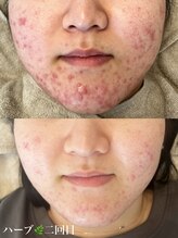 アノ(a'no)/フェイシャルメニュー