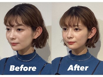 コルミチョン サロン(骨美整 salon)/顎ズレ施術　Before・After