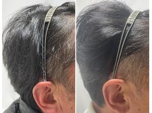 プロセルトリートメントって知ってますか？