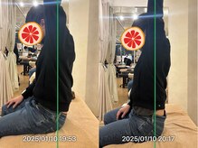 グレフル鍼灸接骨院 整体院 心斎橋/50肩／40肩／可動域制限／夜間痛