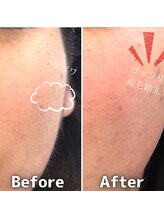 グルーミー(gloomy)/お肌のザラつき解消！！！