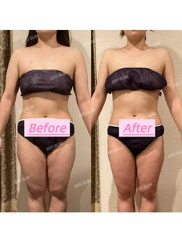 アユスリム(AYU SLIM)/短期集中ケア 充実痩身♪