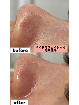 シロ(SHIRO)/毛穴改善