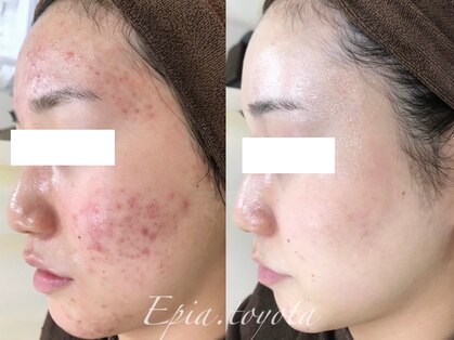 エピア 豊田店(Epia)の写真