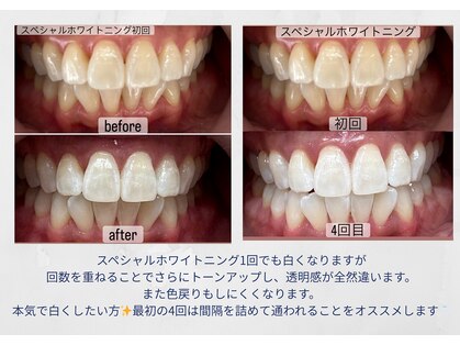 ヤット 森ノ宮(yatto.)の写真