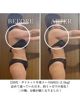 ヨサパーク エラ 恵比寿西(YOSA PARK Ella)/ダイエット卒業コース