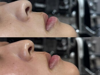 スタジオテーラーシックス(STUDIO TAILORSIX)/毛穴ケア肌が綺麗になるワックス