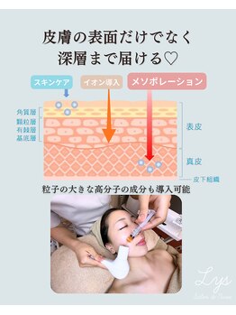 リスサロンドナース(LYS salon de Nurse)/医院レベルの深層へポレーション