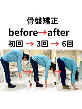 ケートータルビューティー(K. total beauty)/骨盤矯正(顔以外の全身が対象)