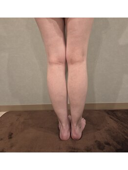 ペア(PEAR)の写真/むくみをケアして足がスッキリ!当店こだわりのむくみケア◎施術後は驚くほど、ほっそり軽やかな足に♪