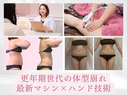 ルポーゼ(Repose)の写真